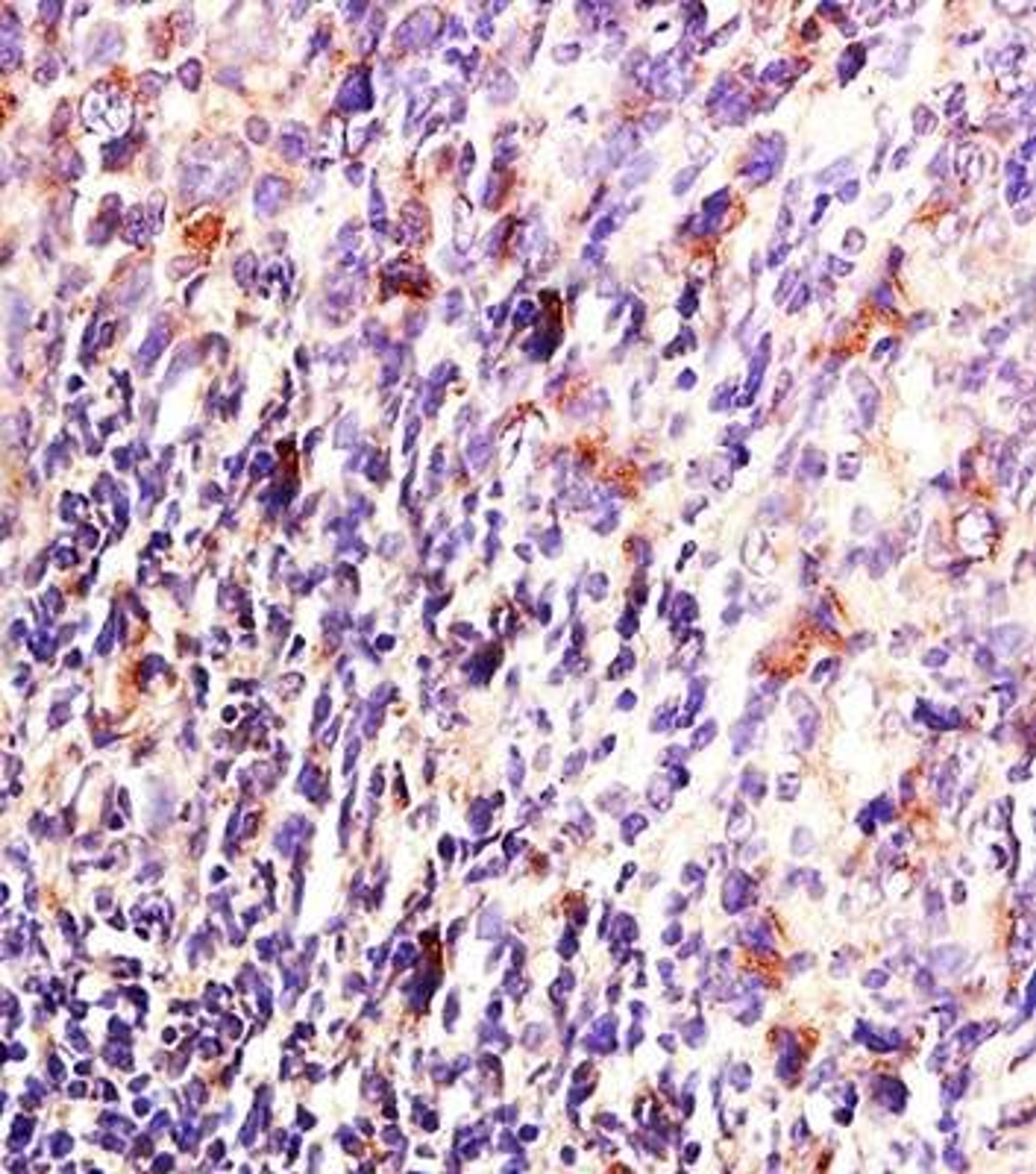 Immunohistochemical analysis of formalin fixed and paraffin embedded mouse lymphoma tissue using MKP-1/DUSP1 antibody