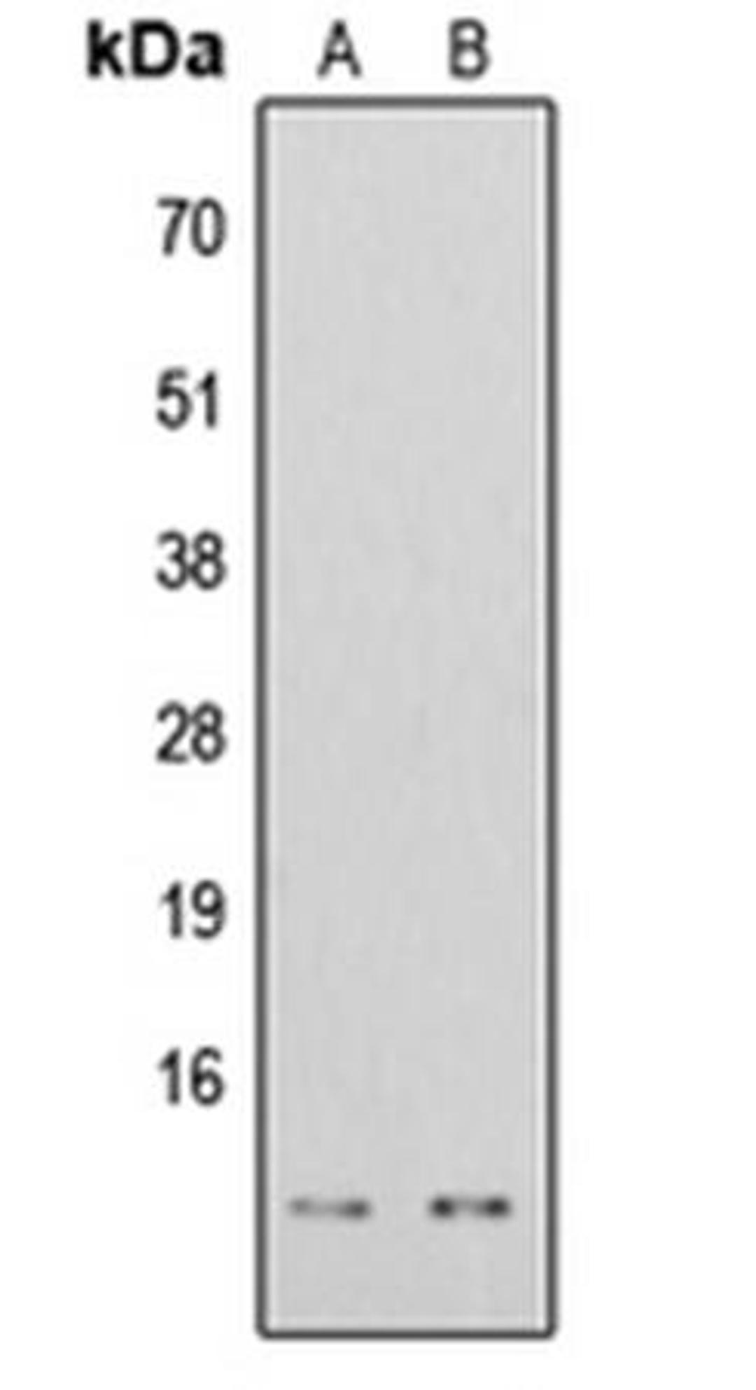 Western blot analysis of HeLa TSA-treated (Lane1), HEK293T TSA-treated (Lane2) whole cell using Histone H4 (AcK16) antibody