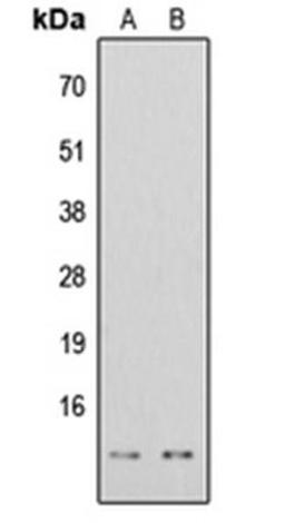 Western blot analysis of HeLa TSA-treated (Lane1), HEK293T TSA-treated (Lane2) whole cell using Histone H4 (AcK16) antibody