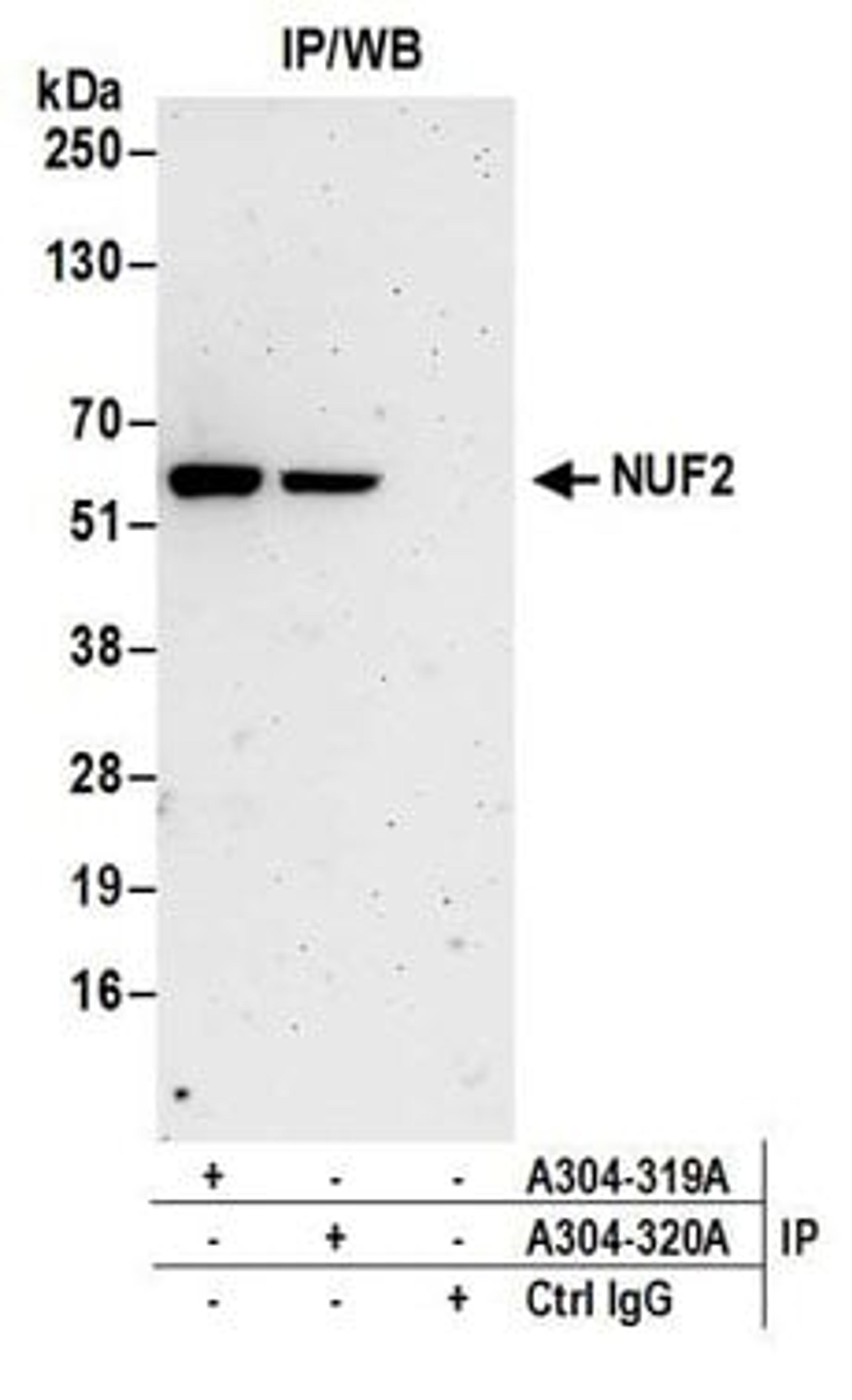 Detection of human NUF2 by western blot of immunoprecipitates.