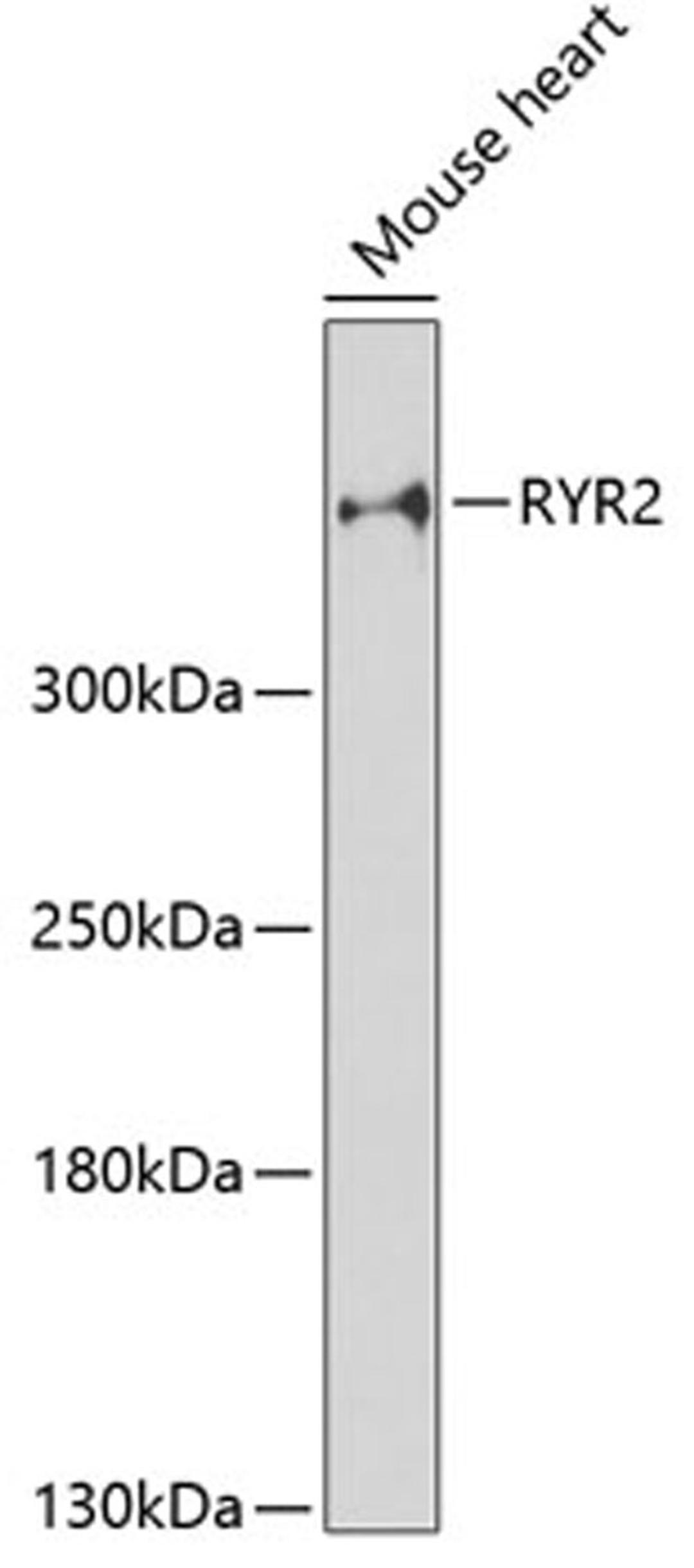 Western blot - RYR2 antibody (A0298)