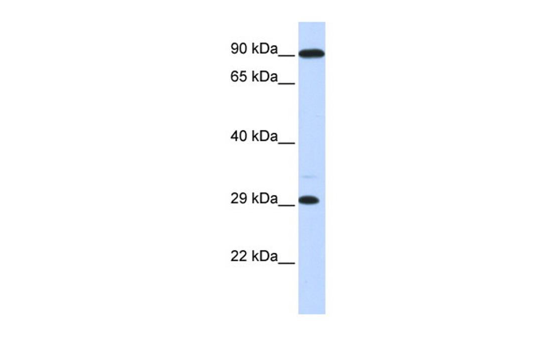 Antibody used in WB on Human Muscle at 0.2-1 ug/ml.