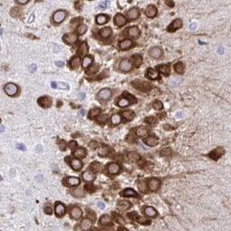 Immunohistochemistry: TMEM35 Antibody [NBP2-31877] - Immunohistochemical staining of human cerebellum shows strong cytoplasmic positivity in Purkinje cells.