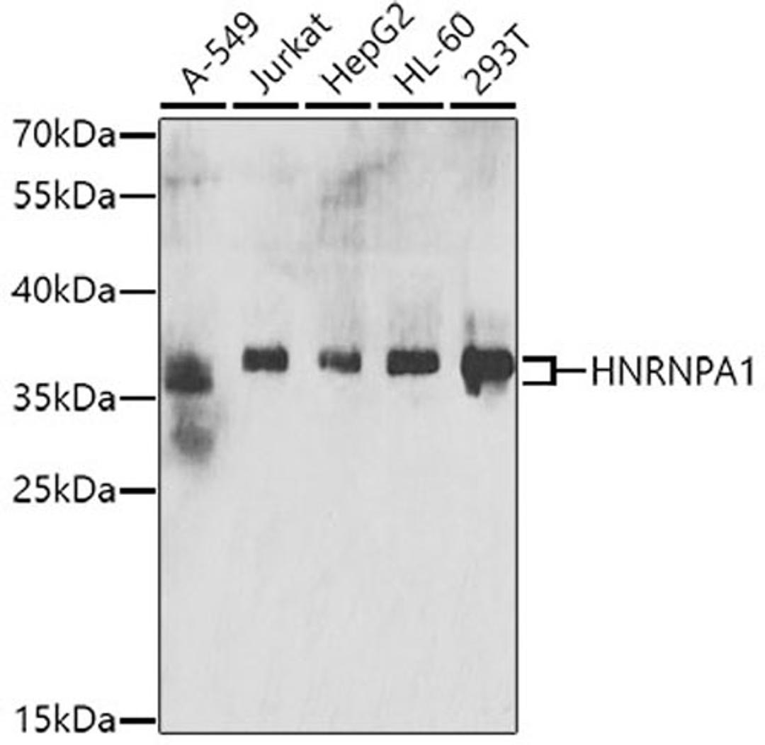 Western blot - HNRNPA1 antibody (A7491)