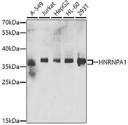 Western blot - HNRNPA1 antibody (A7491)