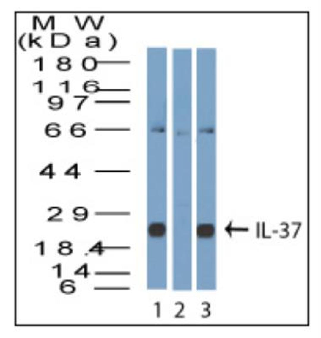 Western Blot: IL1F7 Antibody [NBP2-27200] - Lysate from human A431 cells in the 1) absence and 2) presence of immunizing peptide, and 3) ThP-1 probed with IL-37 antibody at 3 ug/ml.