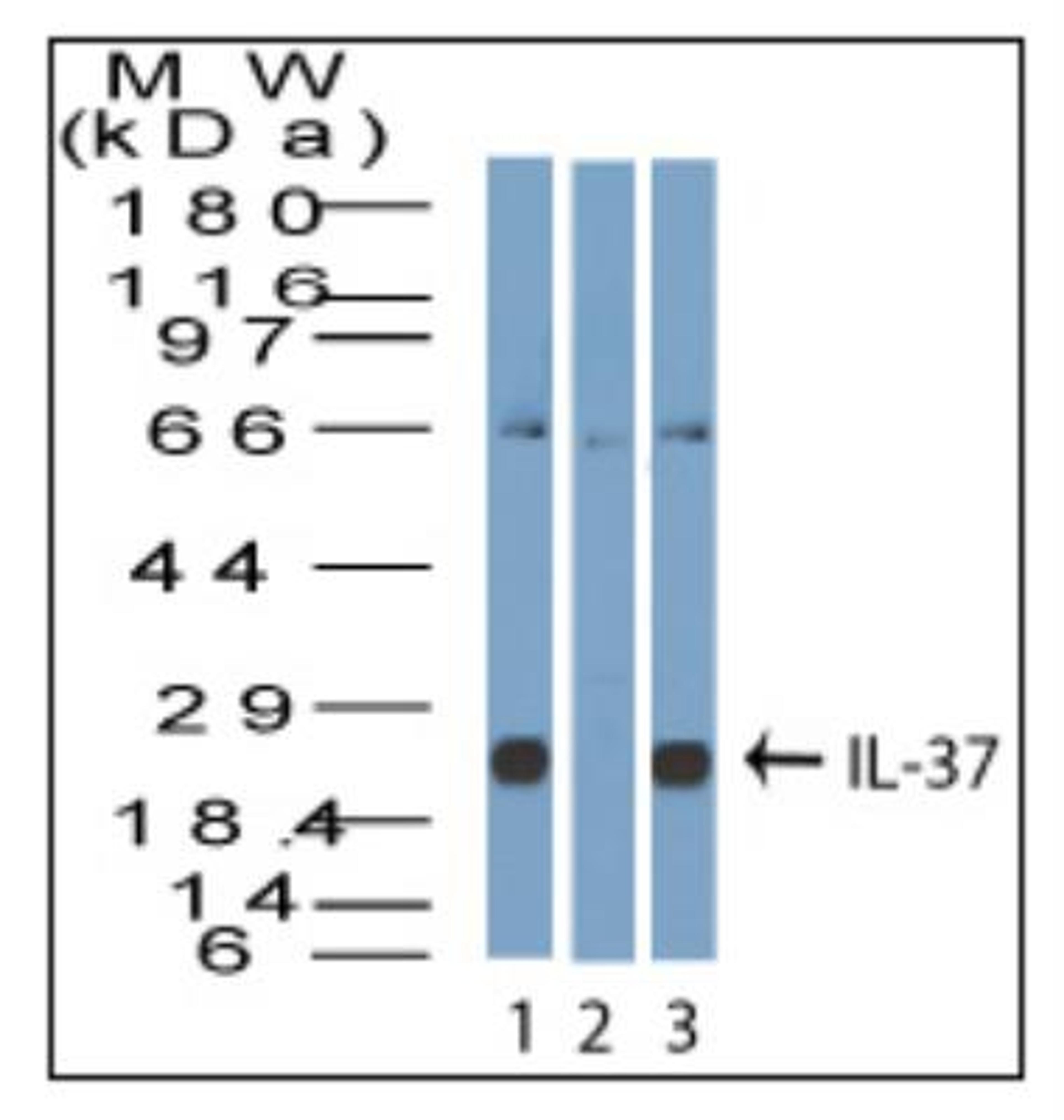 Western Blot: IL1F7 Antibody [NBP2-27200] - Lysate from human A431 cells in the 1) absence and 2) presence of immunizing peptide, and 3) ThP-1 probed with IL-37 antibody at 3 ug/ml.