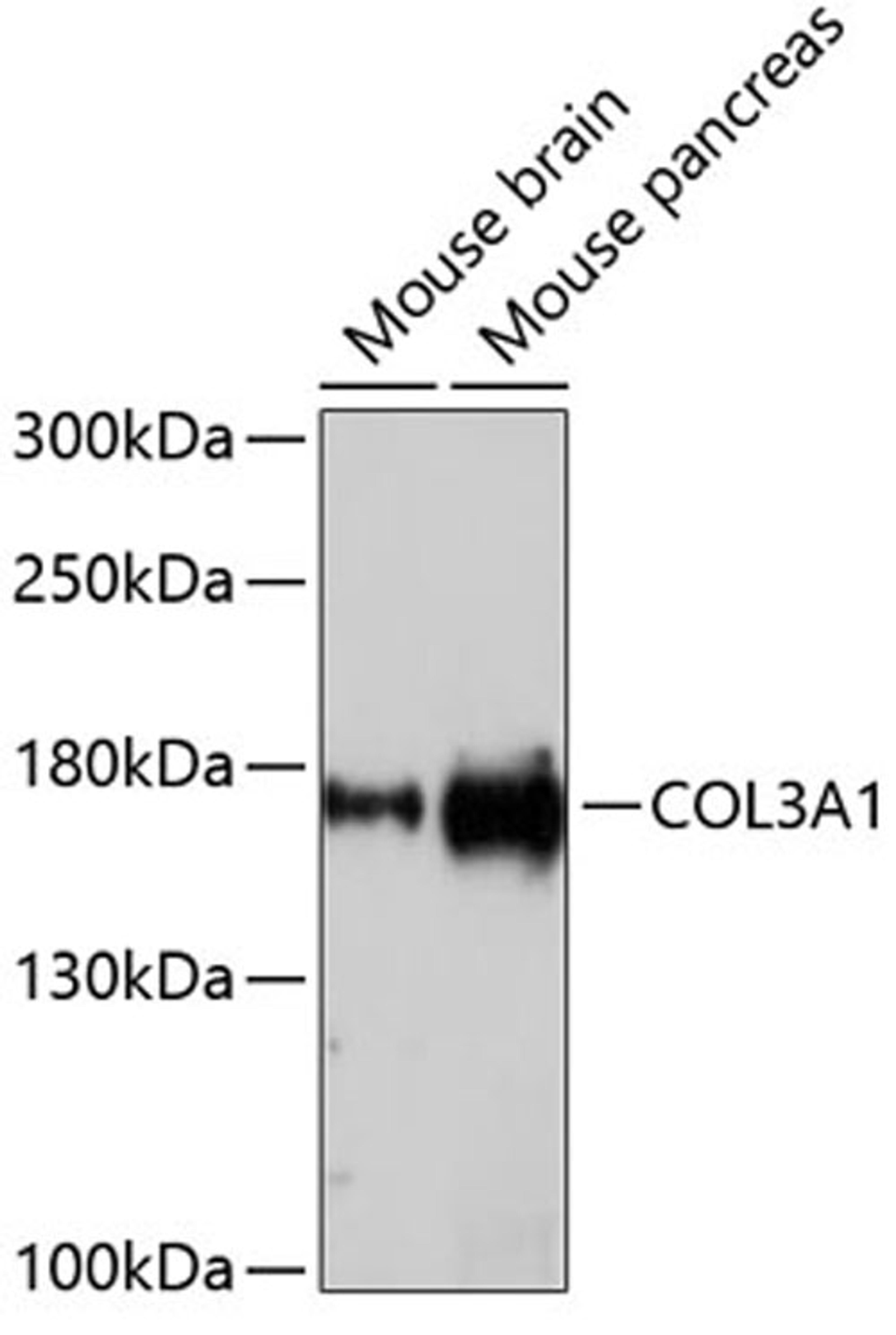 Western blot - COL3A1 antibody (A3795)