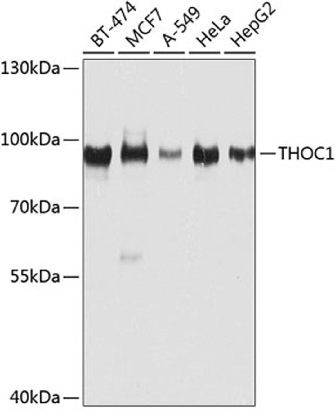 Western blot - THOC1 antibody (A8179)