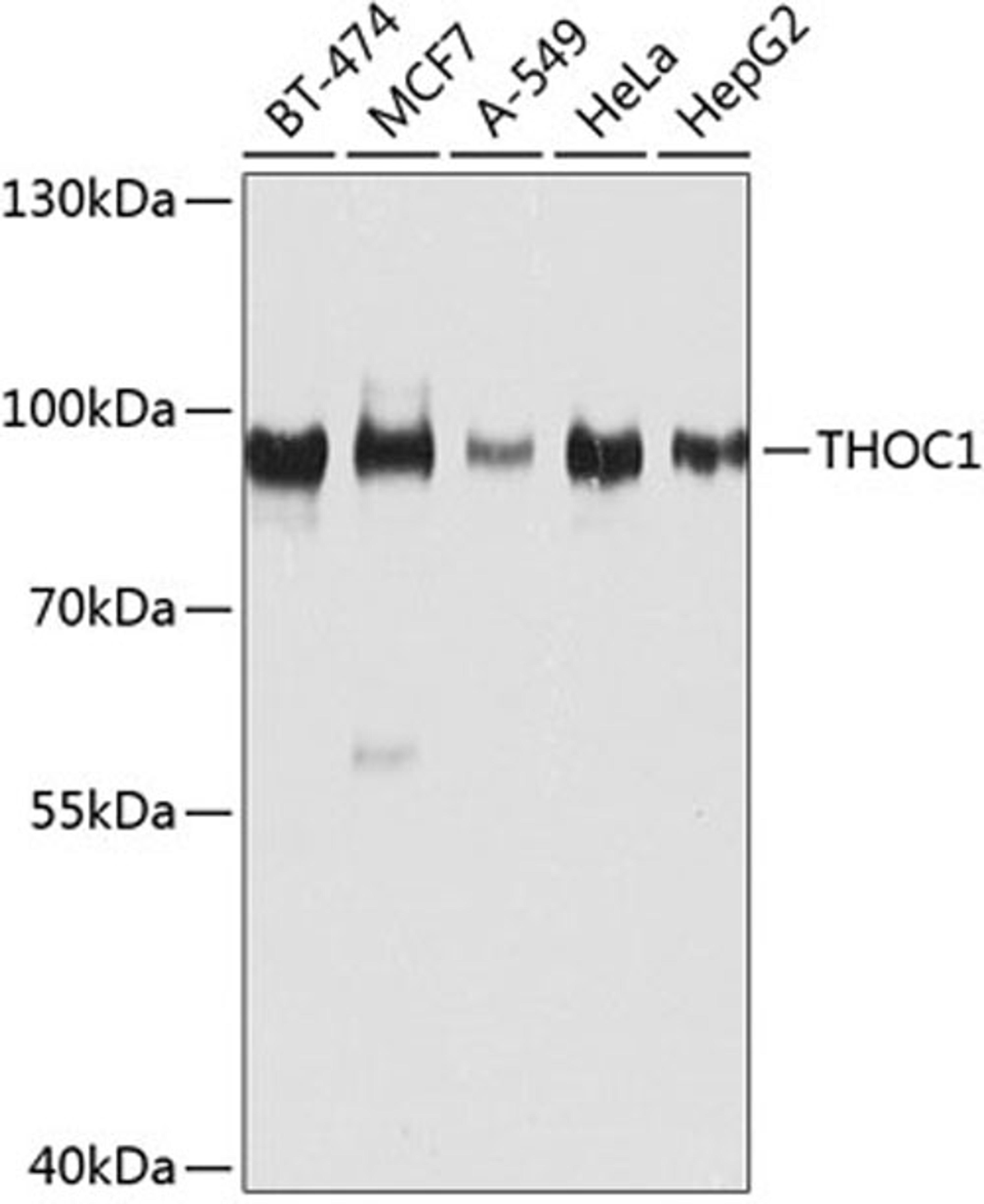 Western blot - THOC1 antibody (A8179)