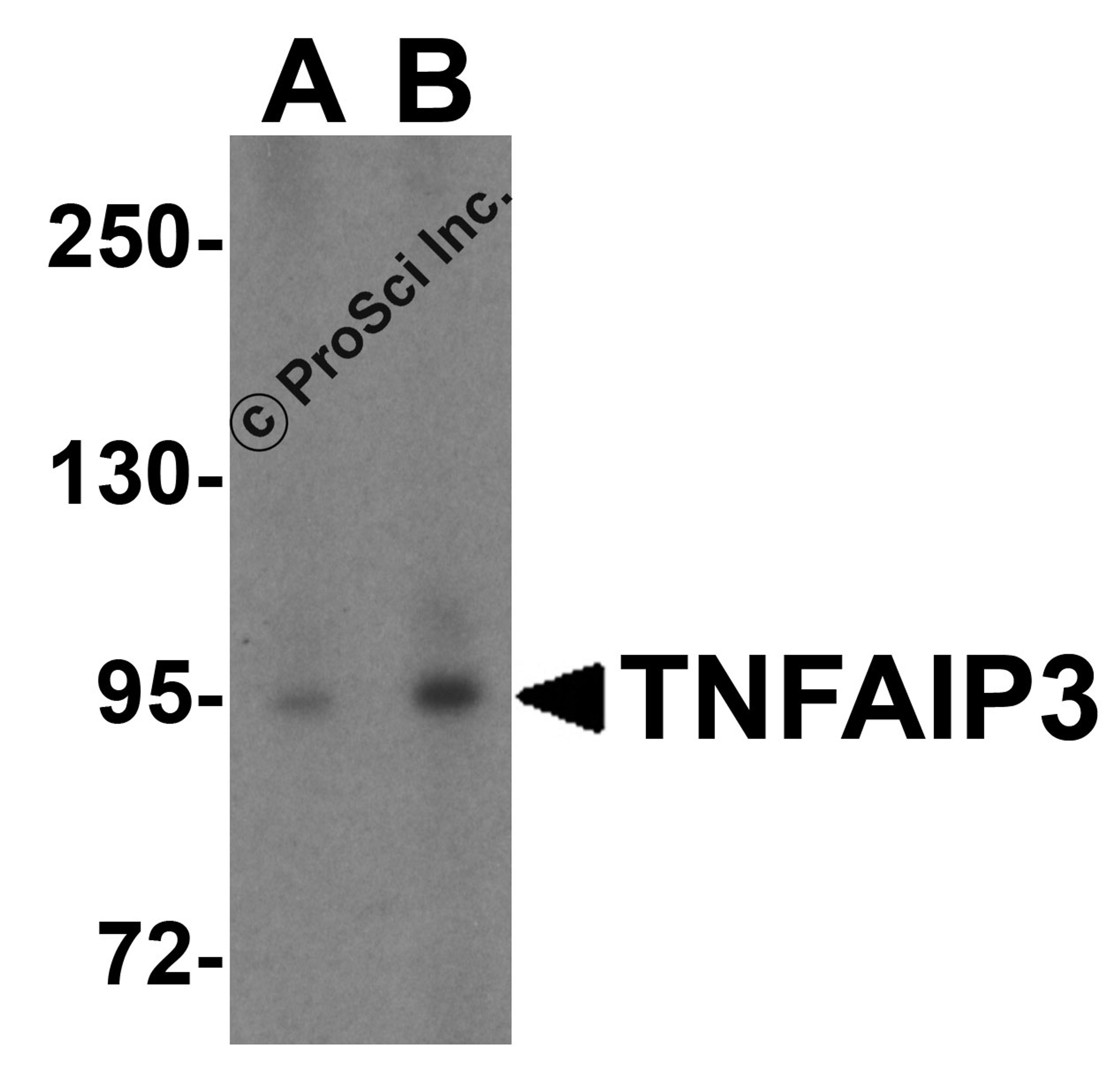 Western blot analysis of TNFAIP3 in Jurkat cell lysate with TNFAIP3 antibody at (A) 1 and (B) 2 &#956;g/mL.