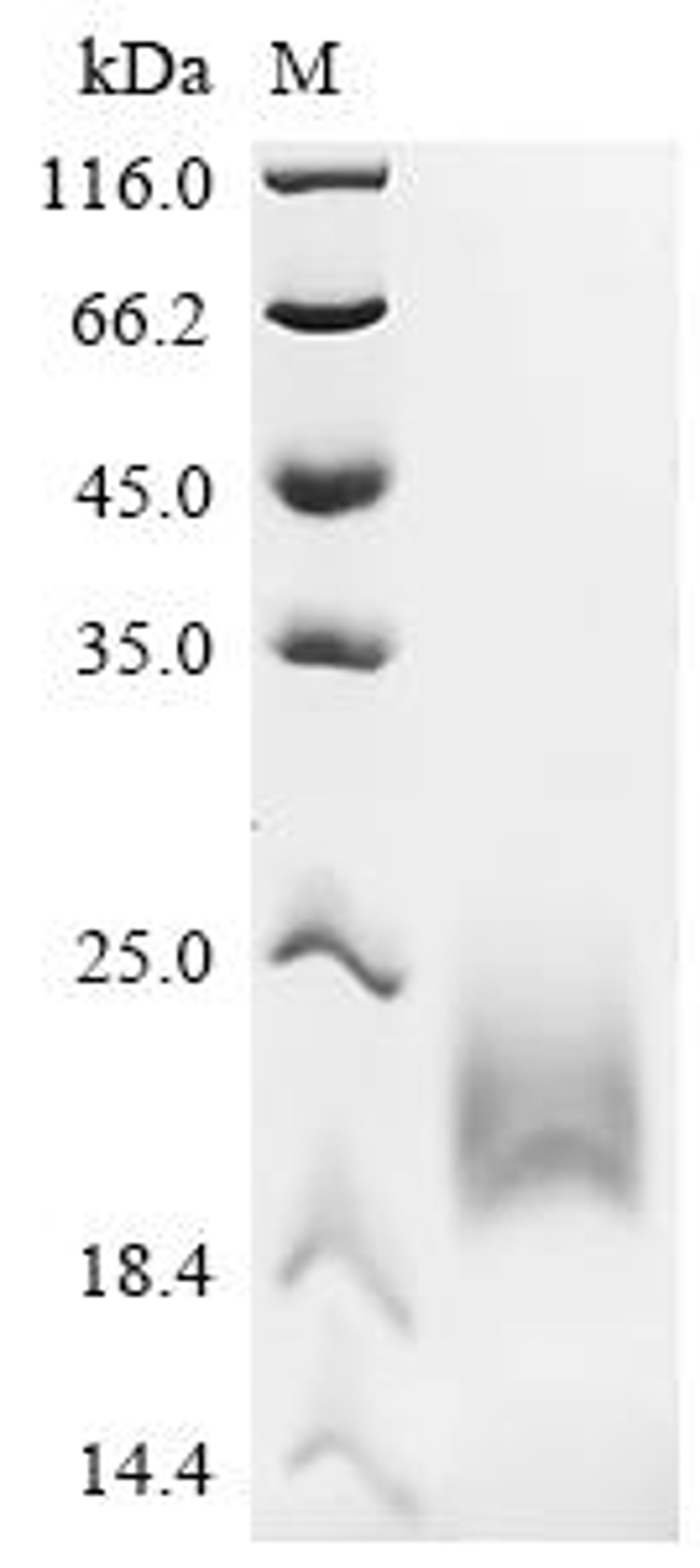 (Tris-Glycine gel) Discontinuous SDS-PAGE (reduced) with 5% enrichment gel and 15% separation gel.