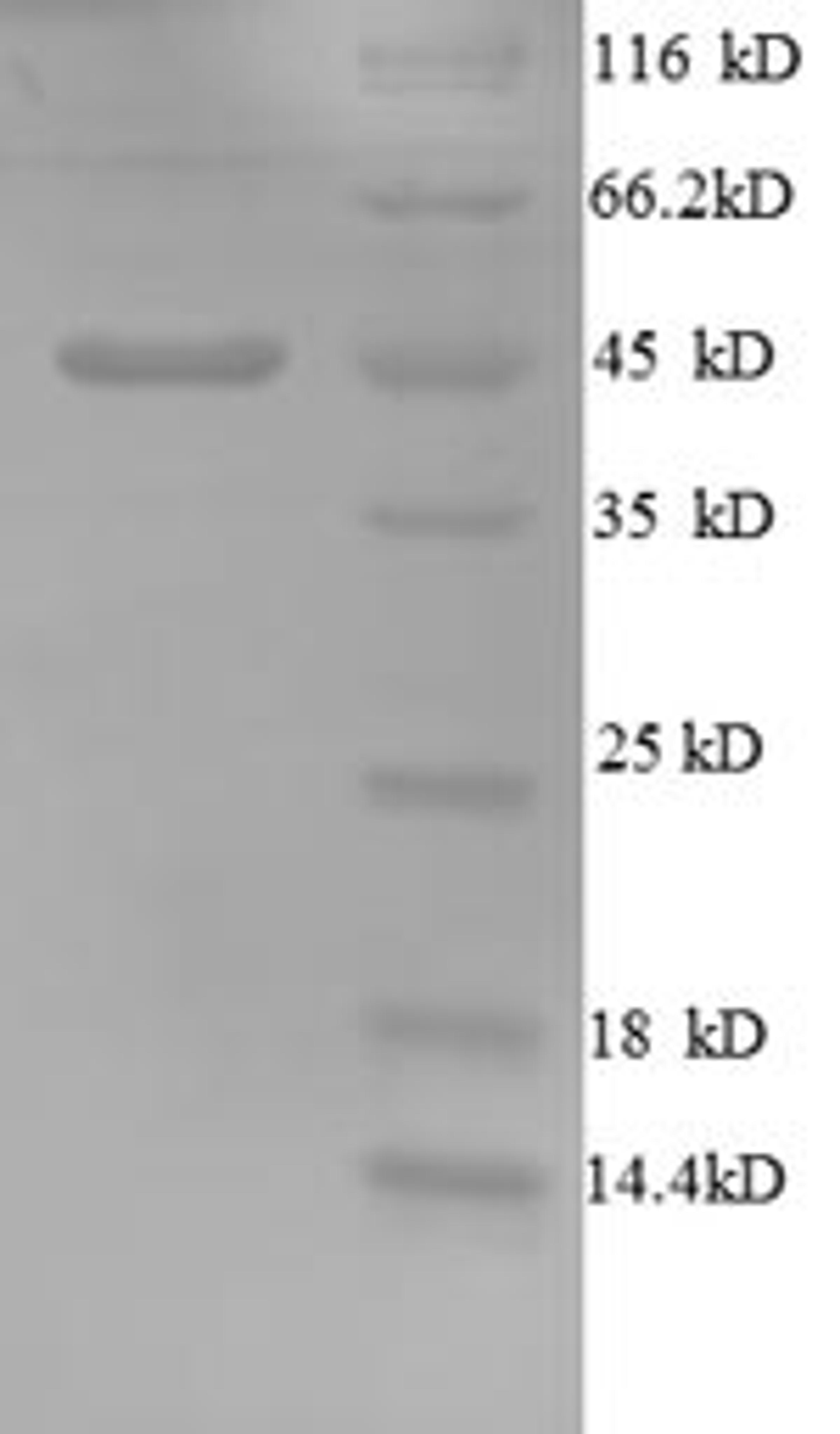 (Tris-Glycine gel) Discontinuous SDS-PAGE (reduced) with 5% enrichment gel and 15% separation gel.