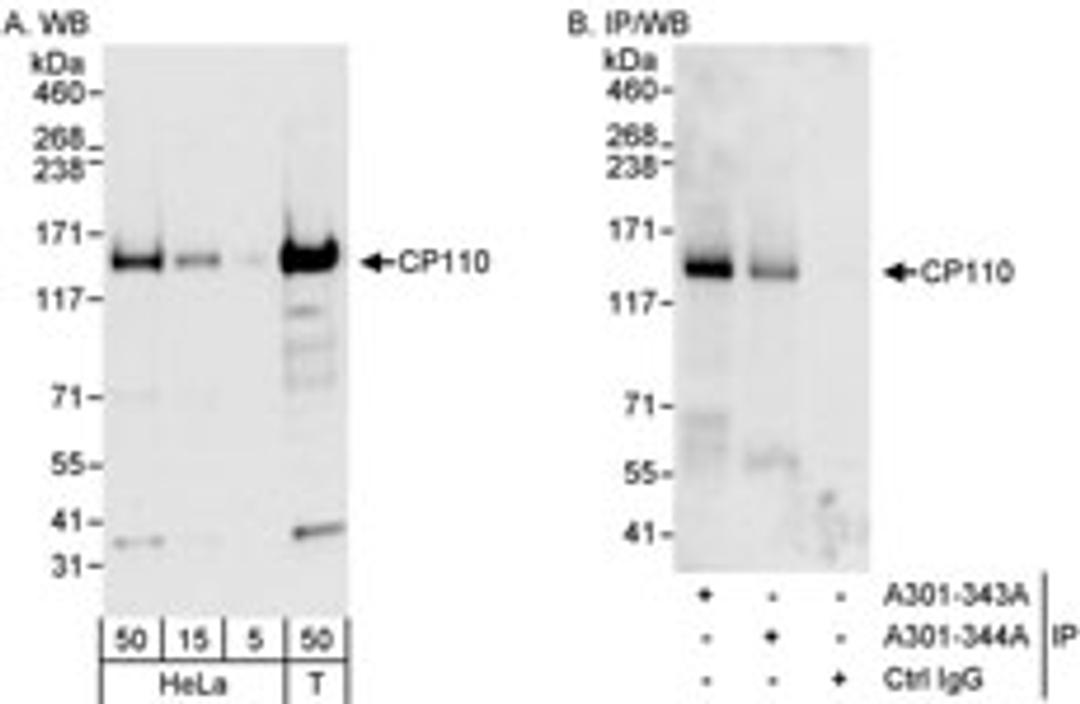 Detection of human CP110 by western blot and immunoprecipitation.