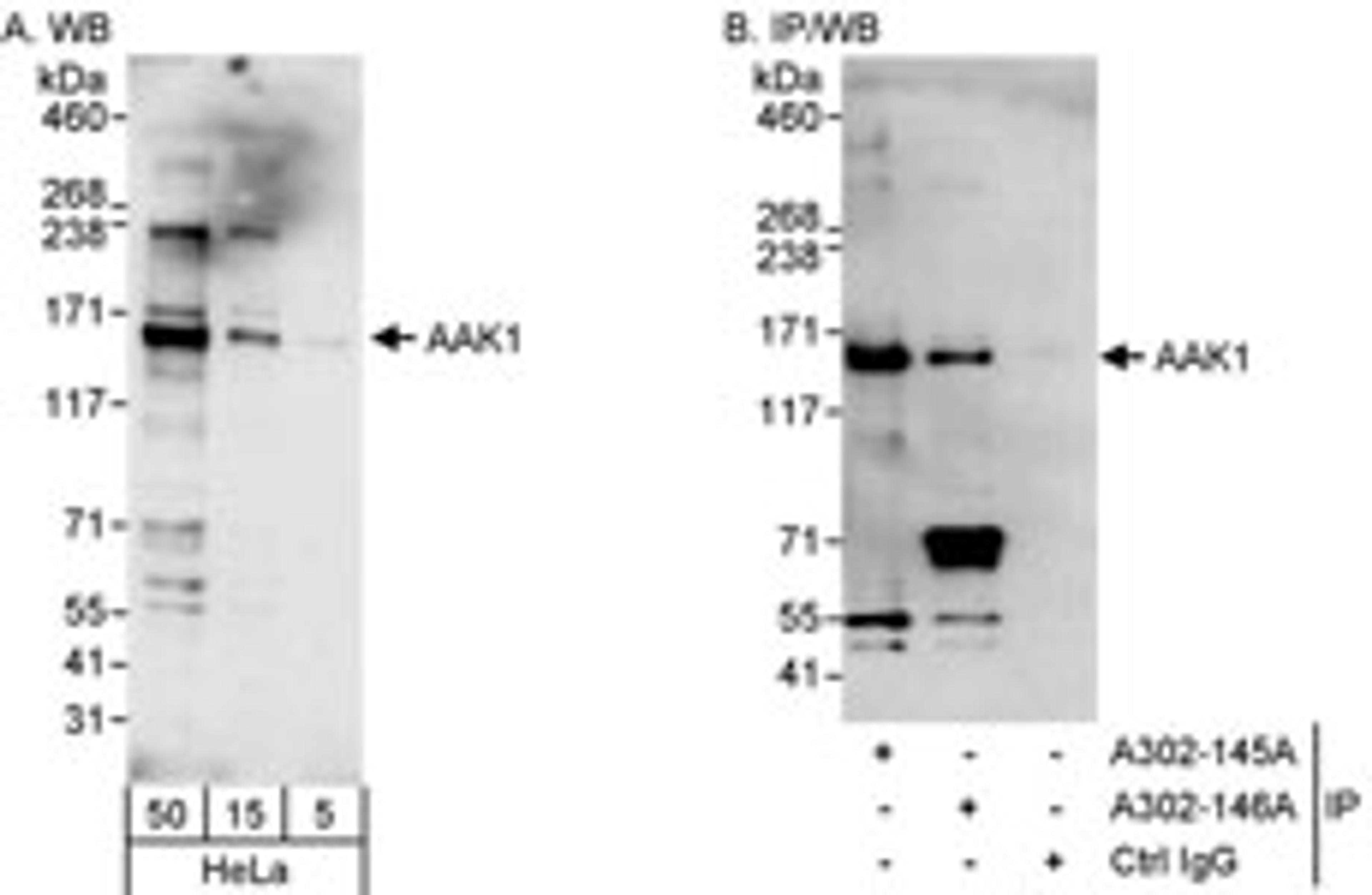 Detection of human AAK1 by western blot and immunoprecipitation.