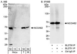 Detection of human and mouse NCOA62 by western blot and immunoprecipitation.