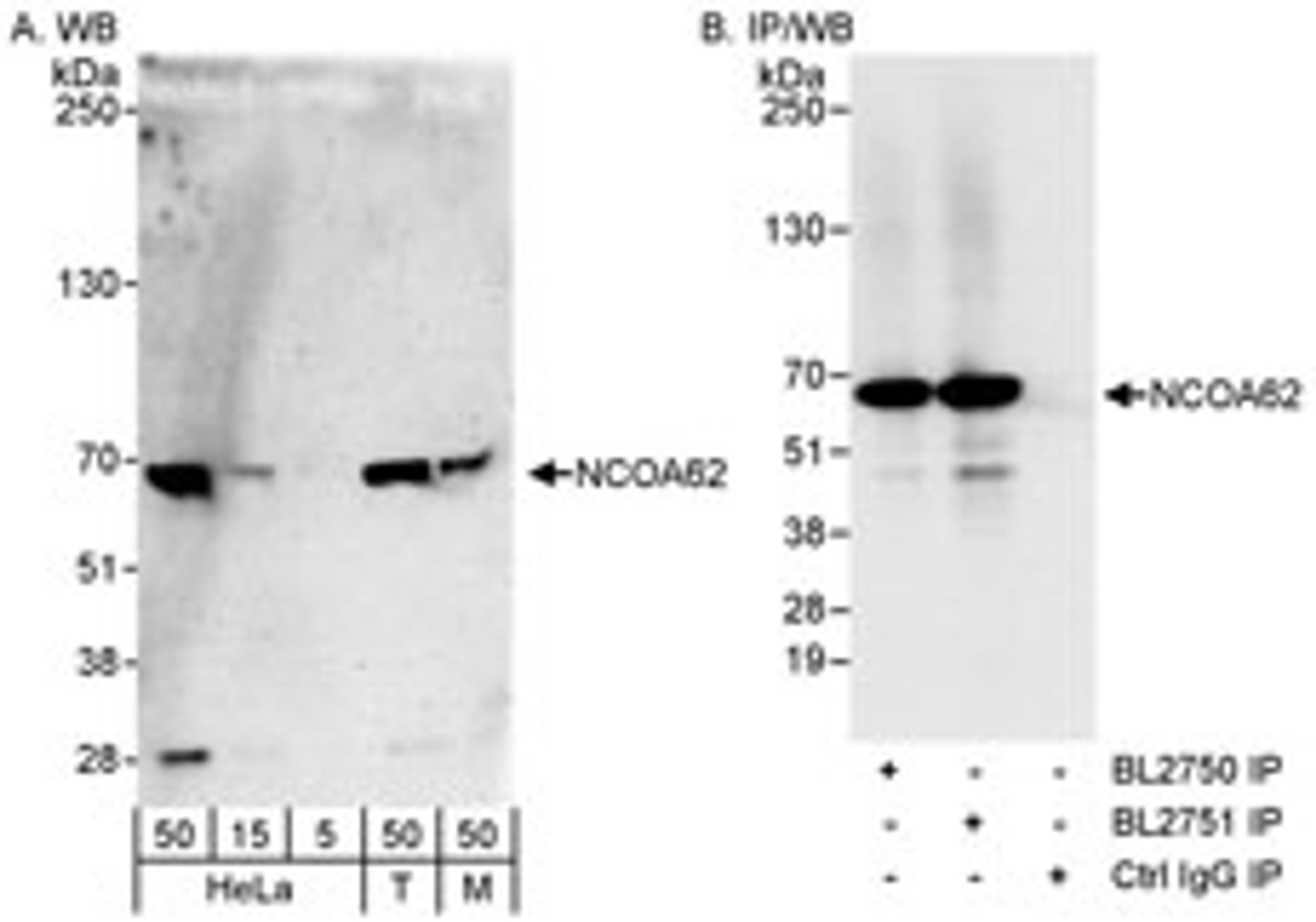 Detection of human and mouse NCOA62 by western blot and immunoprecipitation.