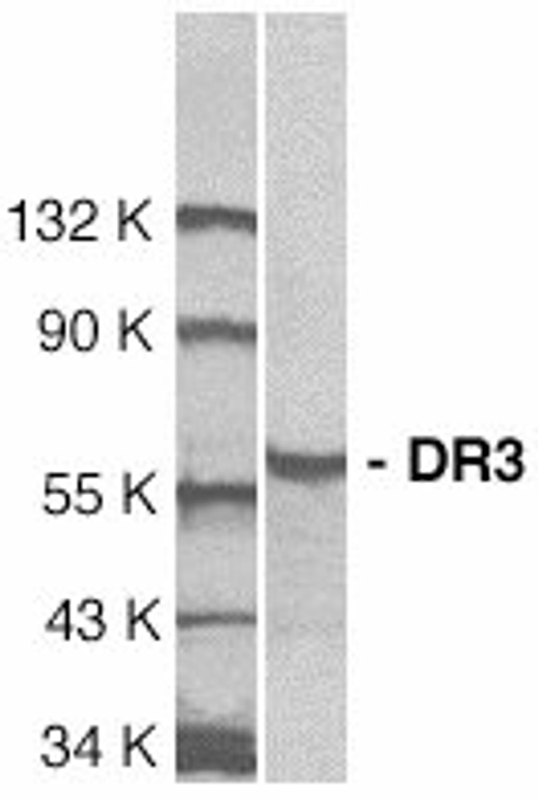 Western blot analysis of whole cell lysate from Jurkat cells probed with Rabbit anti Human DR3