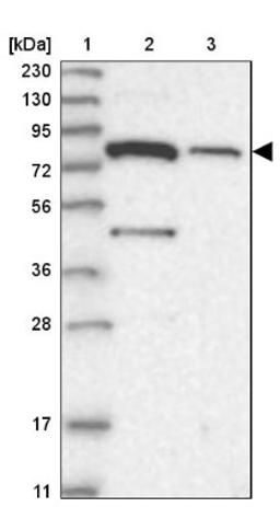 Western Blot: SLC6A12 Antibody [NBP1-88641] - Lane 1: Marker [kDa] 230, 130, 95, 72, 56, 36, 28, 17, 11<br/>Lane 2: Human cell line RT-4<br/>Lane 3: Human cell line U-251MG sp