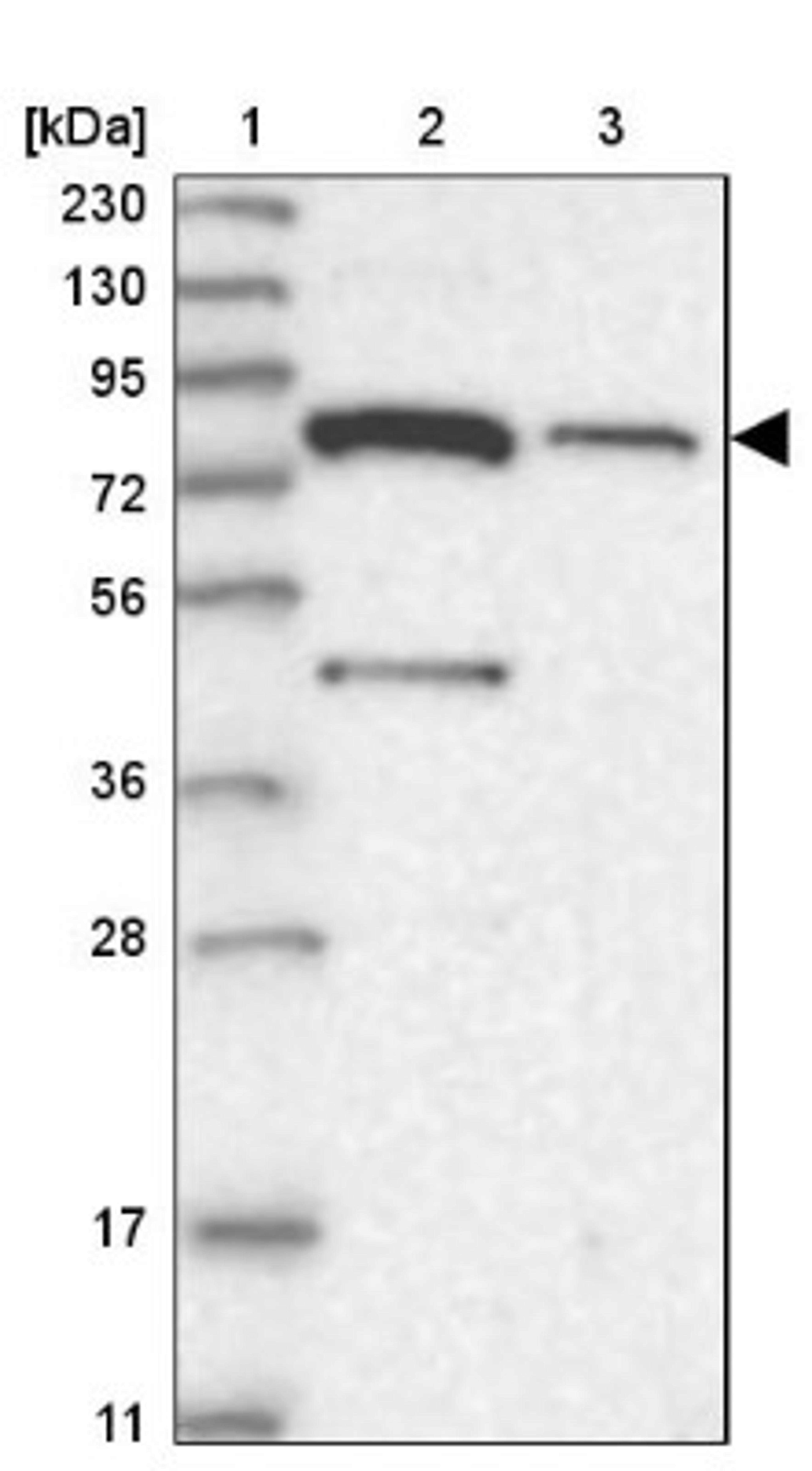 Western Blot: SLC6A12 Antibody [NBP1-88641] - Lane 1: Marker [kDa] 230, 130, 95, 72, 56, 36, 28, 17, 11<br/>Lane 2: Human cell line RT-4<br/>Lane 3: Human cell line U-251MG sp