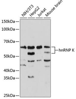 Western blot - hnRNP K Rabbit mAb (A0772)