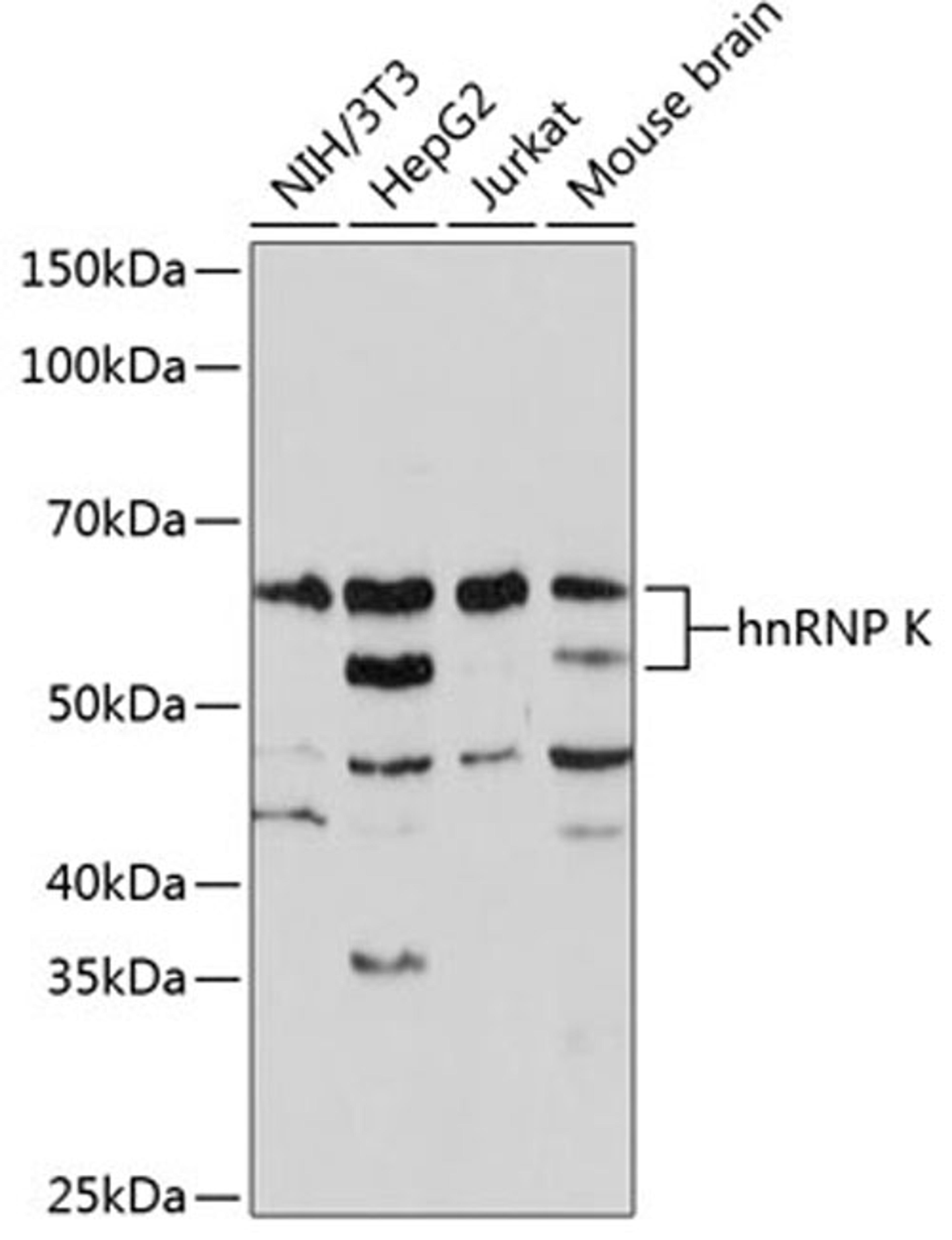 Western blot - hnRNP K Rabbit mAb (A0772)