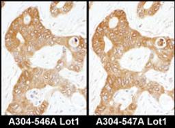 Detection of human ADE2 by immunohistochemistry.