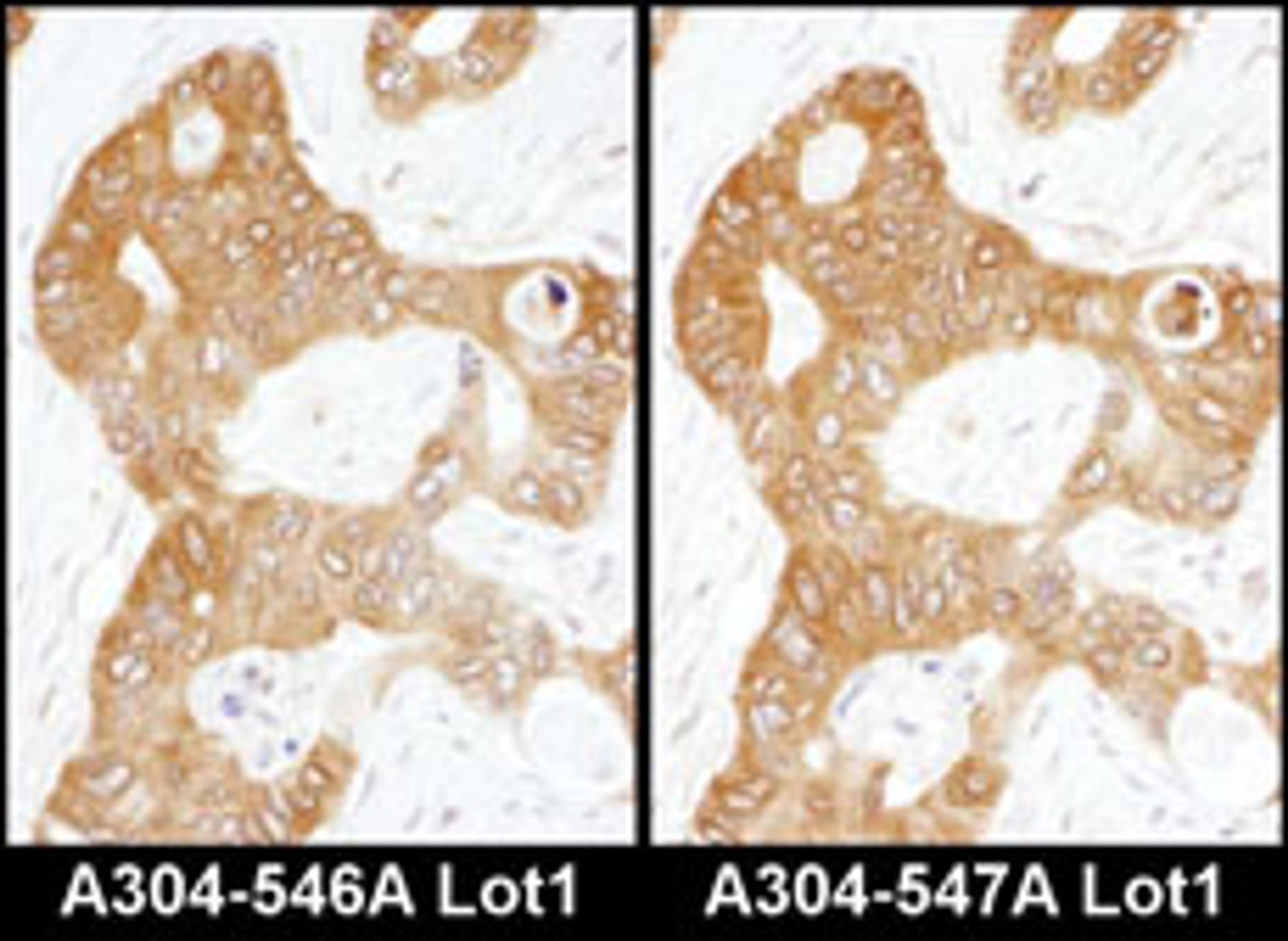 Detection of human ADE2 by immunohistochemistry.