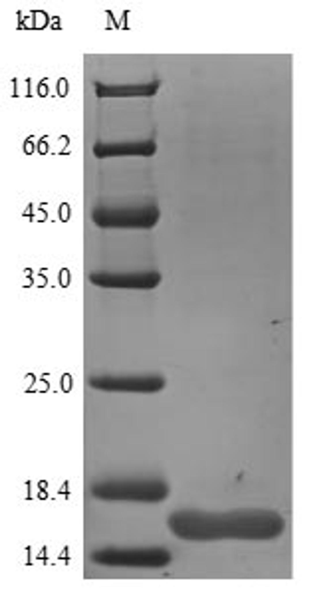 (Tris-Glycine gel) Discontinuous SDS-PAGE (reduced) with 5% enrichment gel and 15% separation gel.