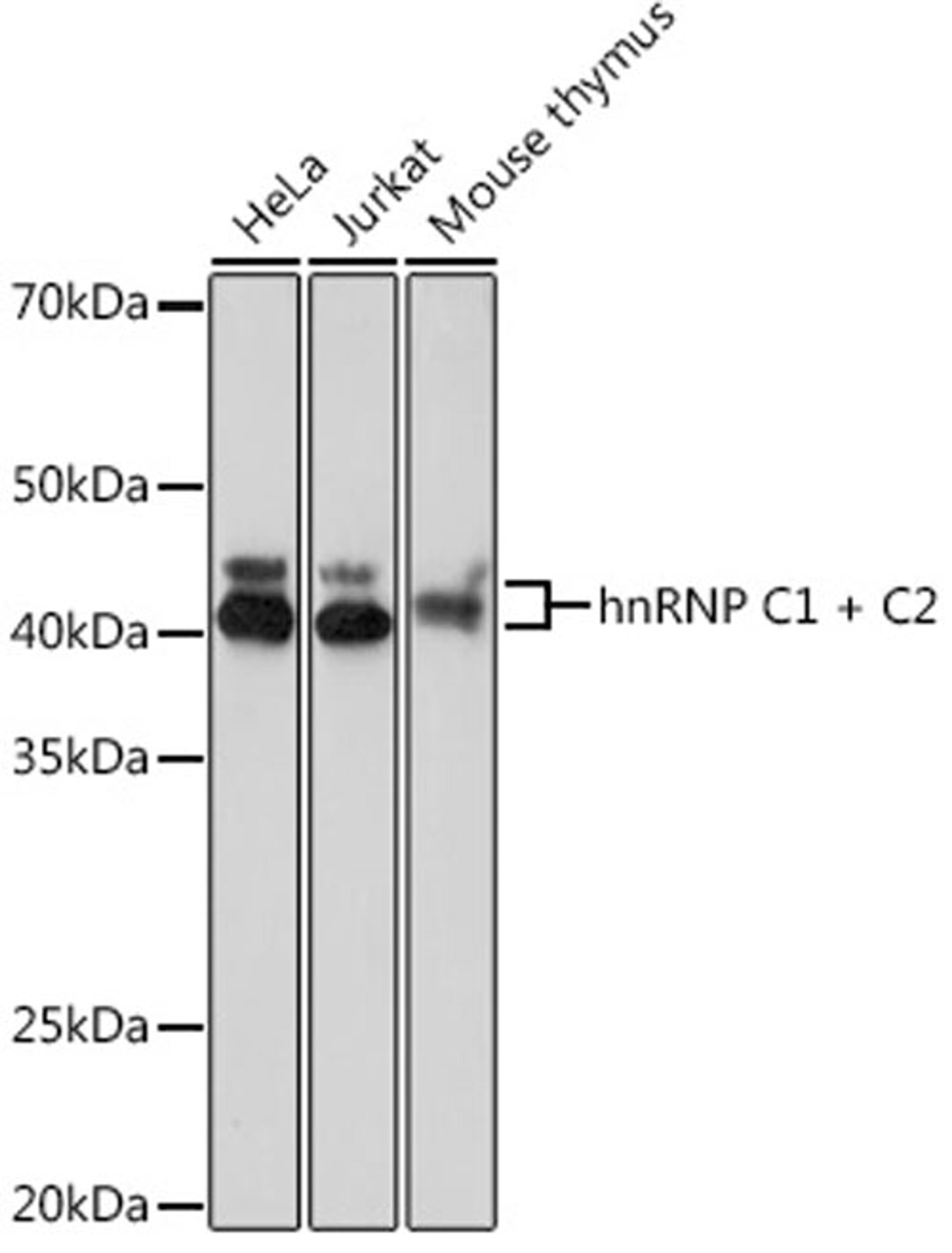 Western blot - hnRNP C1 + C2 Rabbit mAb (A8958)