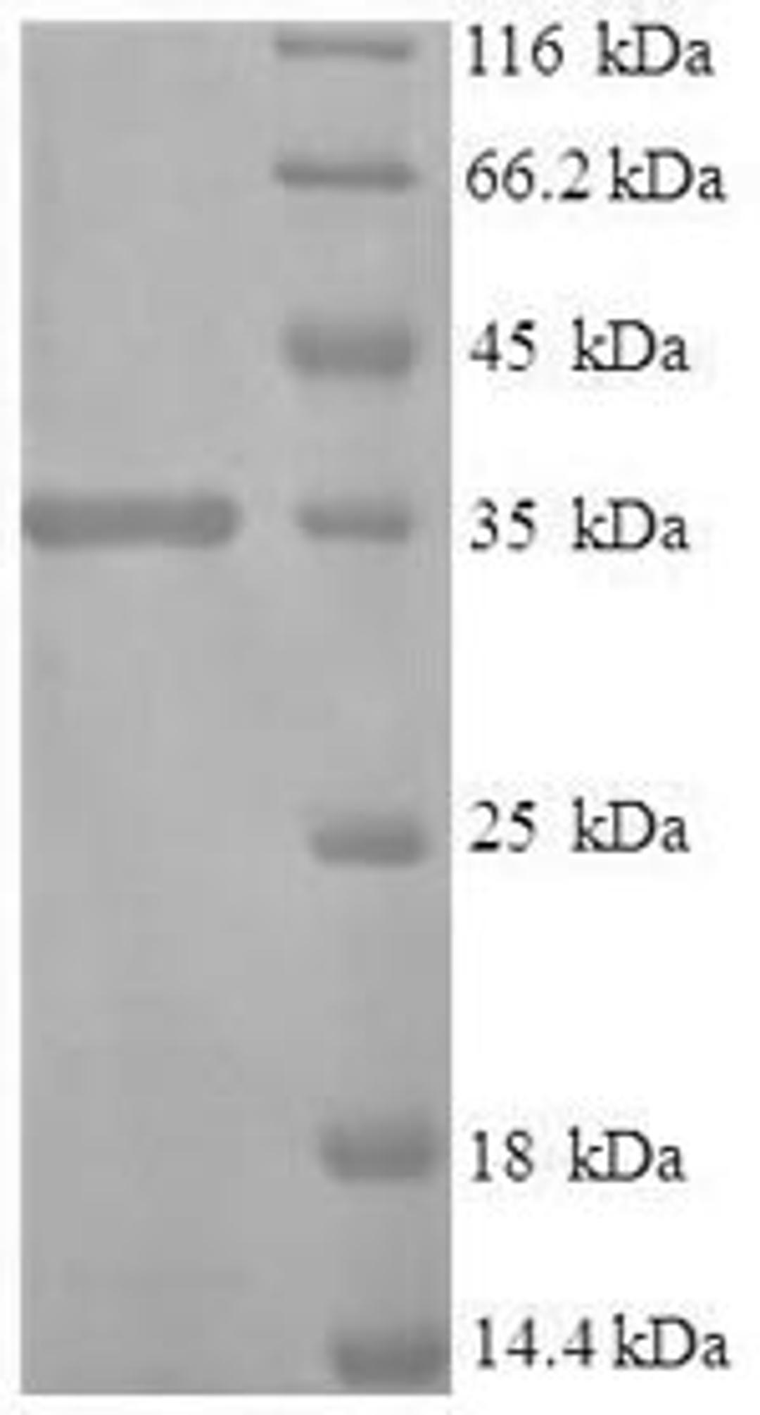(Tris-Glycine gel) Discontinuous SDS-PAGE (reduced) with 5% enrichment gel and 15% separation gel.