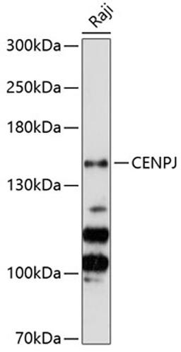 Western blot - CENPJ Antibody (A8721)