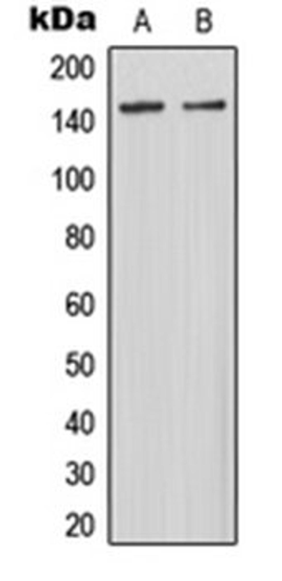 Western blot analysis of HepG2 (Lane 1), rat kidney (Lane 2) whole cell lysates using MAST3 antibody