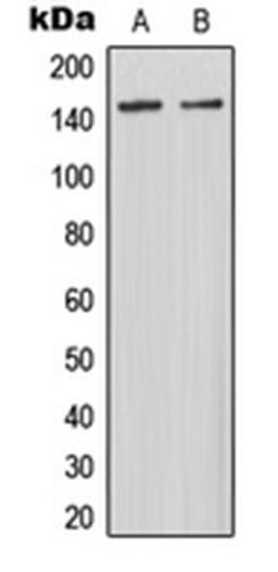 Western blot analysis of HepG2 (Lane 1), rat kidney (Lane 2) whole cell lysates using MAST3 antibody