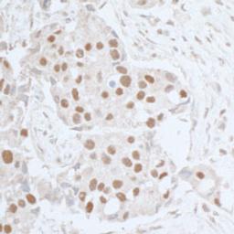 Detection of human Leo1 by immunohistochemistry.