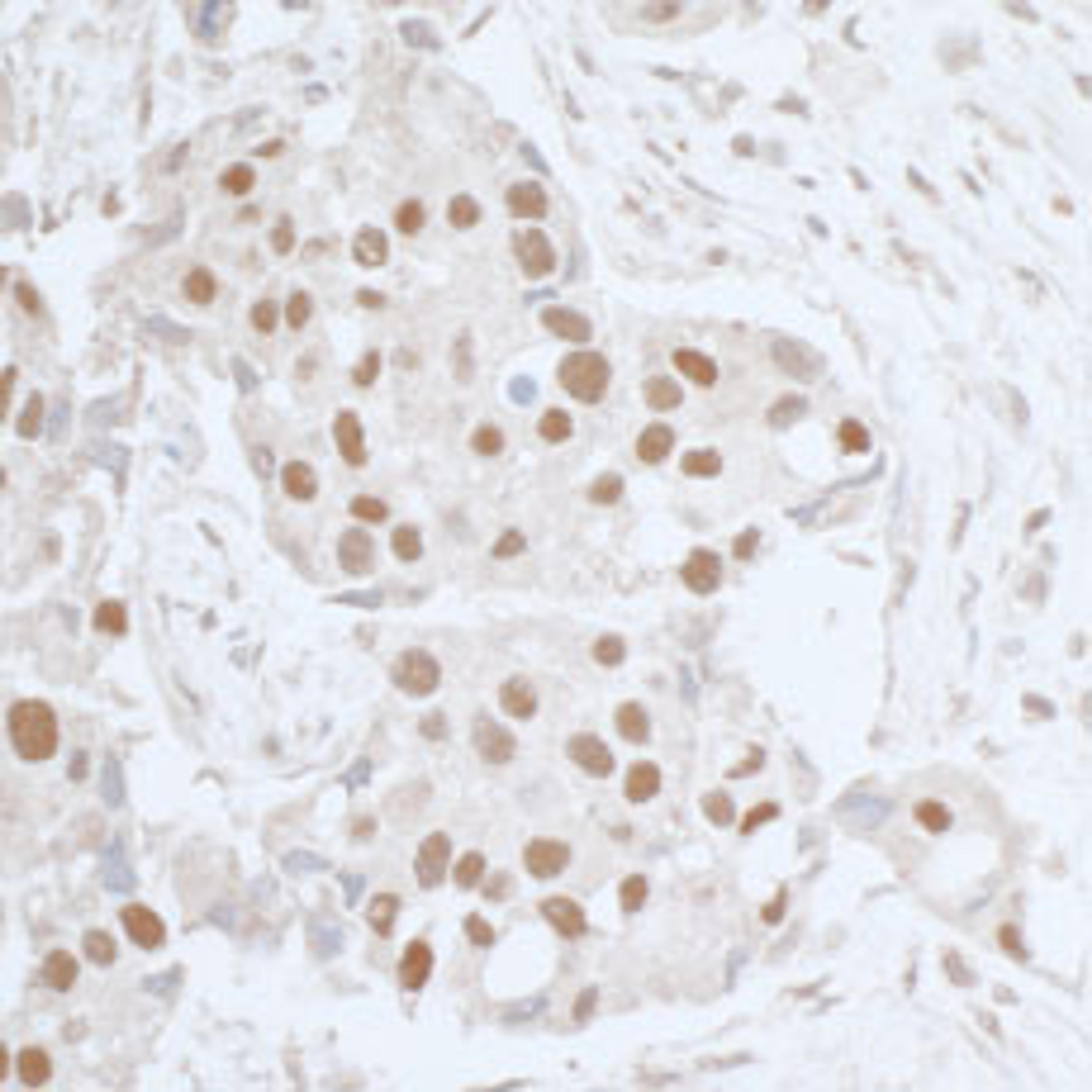 Detection of human Leo1 by immunohistochemistry.