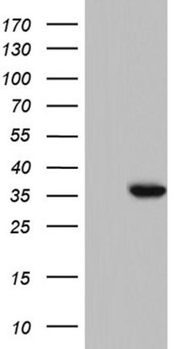 Western Blot: enkurin Antibody (6C10) [NBP2-45428] - Analysis of HEK293T cells were transfected with the pCMV6-ENTRY control (Left lane) or pCMV6-ENTRY enkurin.