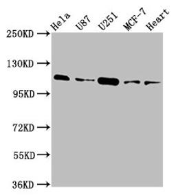 Western Blot. Positive WB detected in: Hela whole cell lysate, U87 whole cell lysate, U251 whole cell lysate, MCF-7 whole cell lysate, Rat heart tissue. All lanes: ANO2 antibody at 3.9µg/ml. Secondary. Goat polyclonal to rabbit IgG at 1/50000 dilution. Predicted band size: 114 kDa. Observed band size: 114 kDa