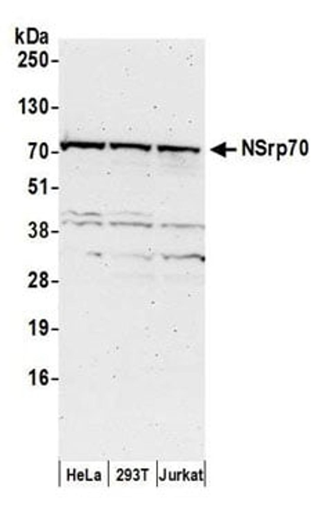 Detection of human NSrp70 by western blot.