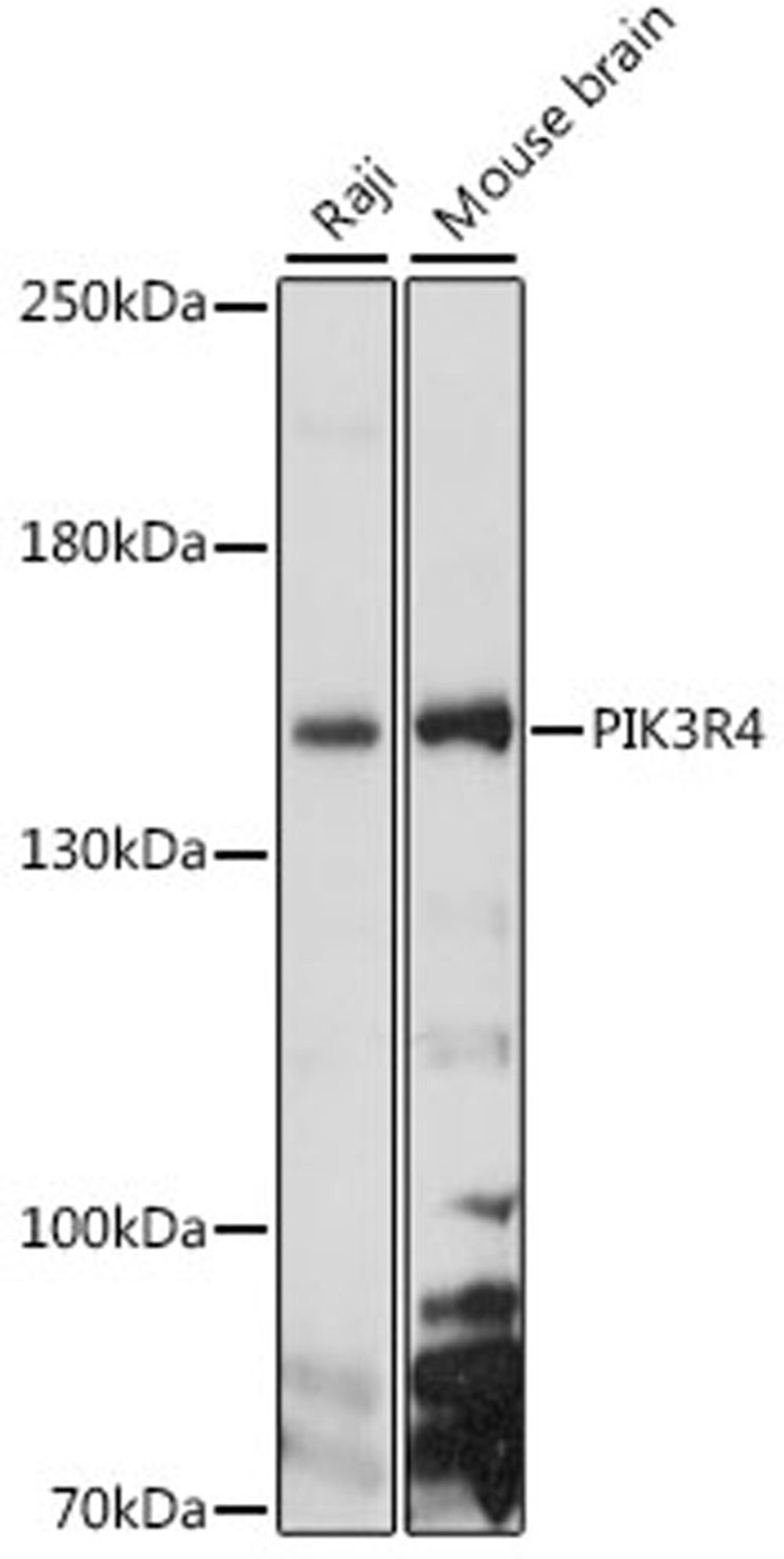 Western blot - PIK3R4 antibody (A15828)