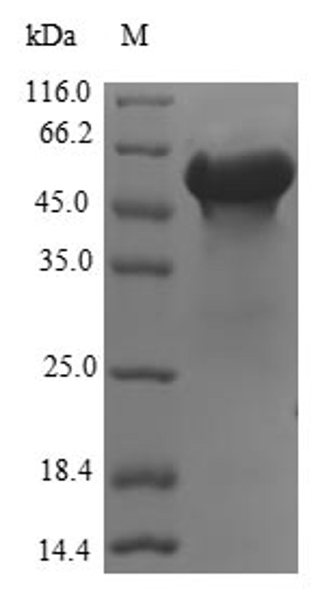 (Tris-Glycine gel) Discontinuous SDS-PAGE (reduced) with 5% enrichment gel and 15% separation gel.