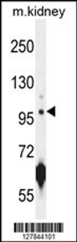 Western blot analysis in mouse kidney tissue lysates (35ug/lane).