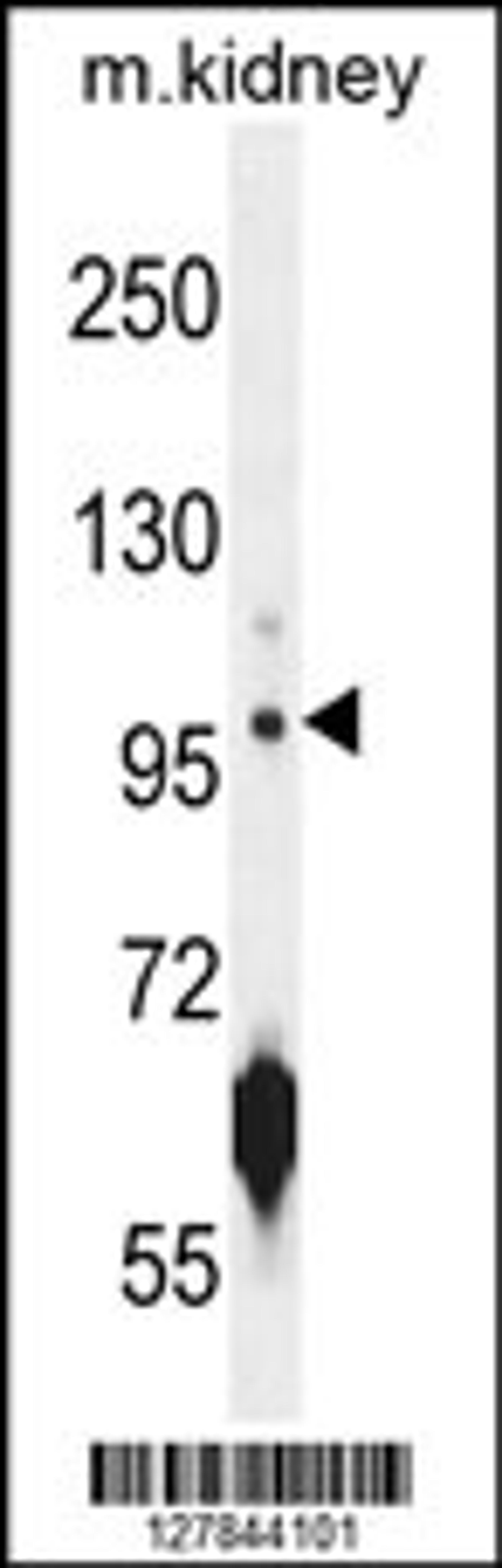 Western blot analysis in mouse kidney tissue lysates (35ug/lane).