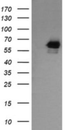 Western Blot: RIOK2 Antibody (3E11) [NBP2-45960] - Analysis of HEK293T cells were transfected with the pCMV6-ENTRY control (Left lane) or pCMV6-ENTRY RIOK2.