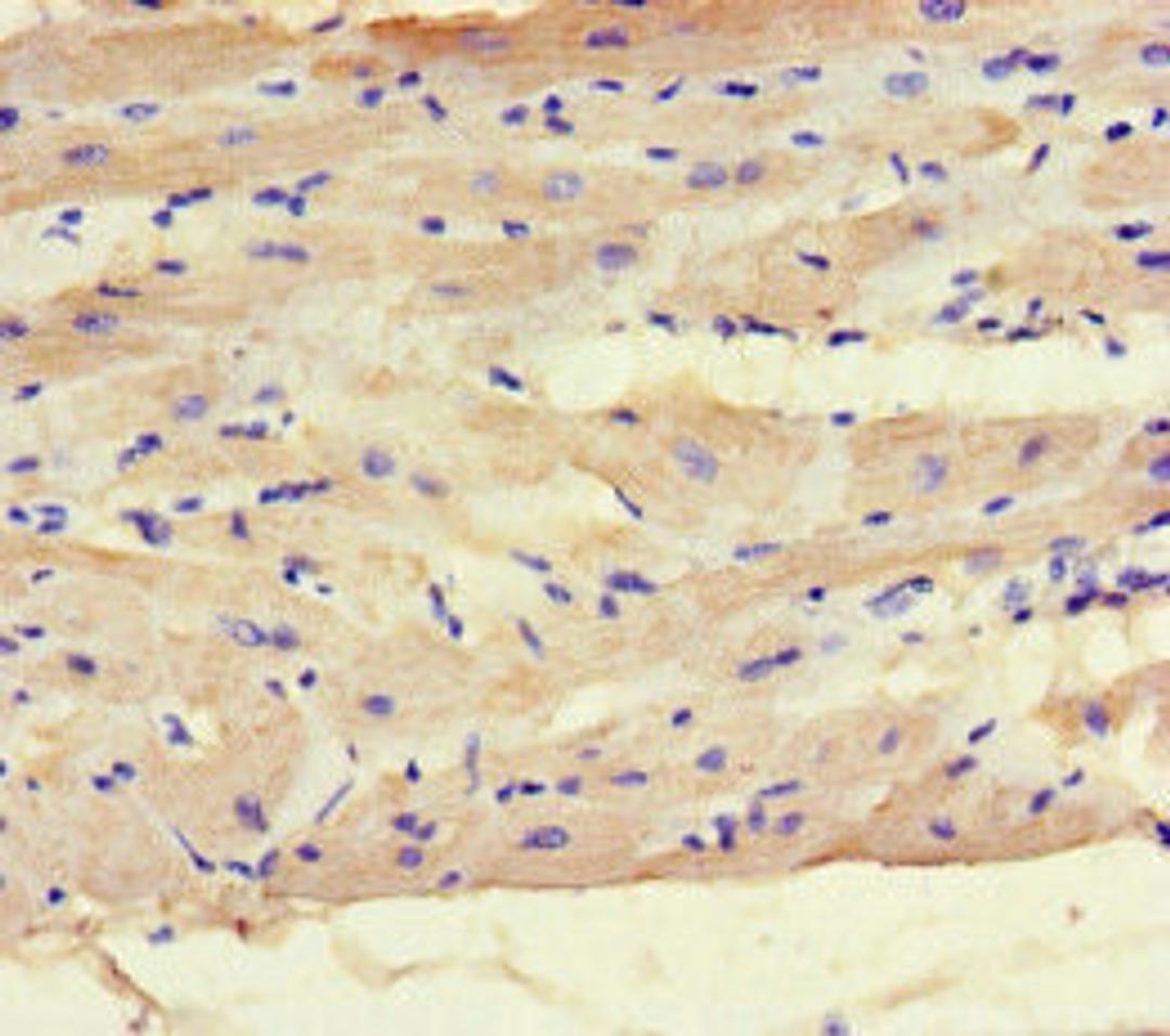 Immunohistochemistry of paraffin-embedded human heart tissue using CSB-PA013527LA01HU at dilution of 1:100