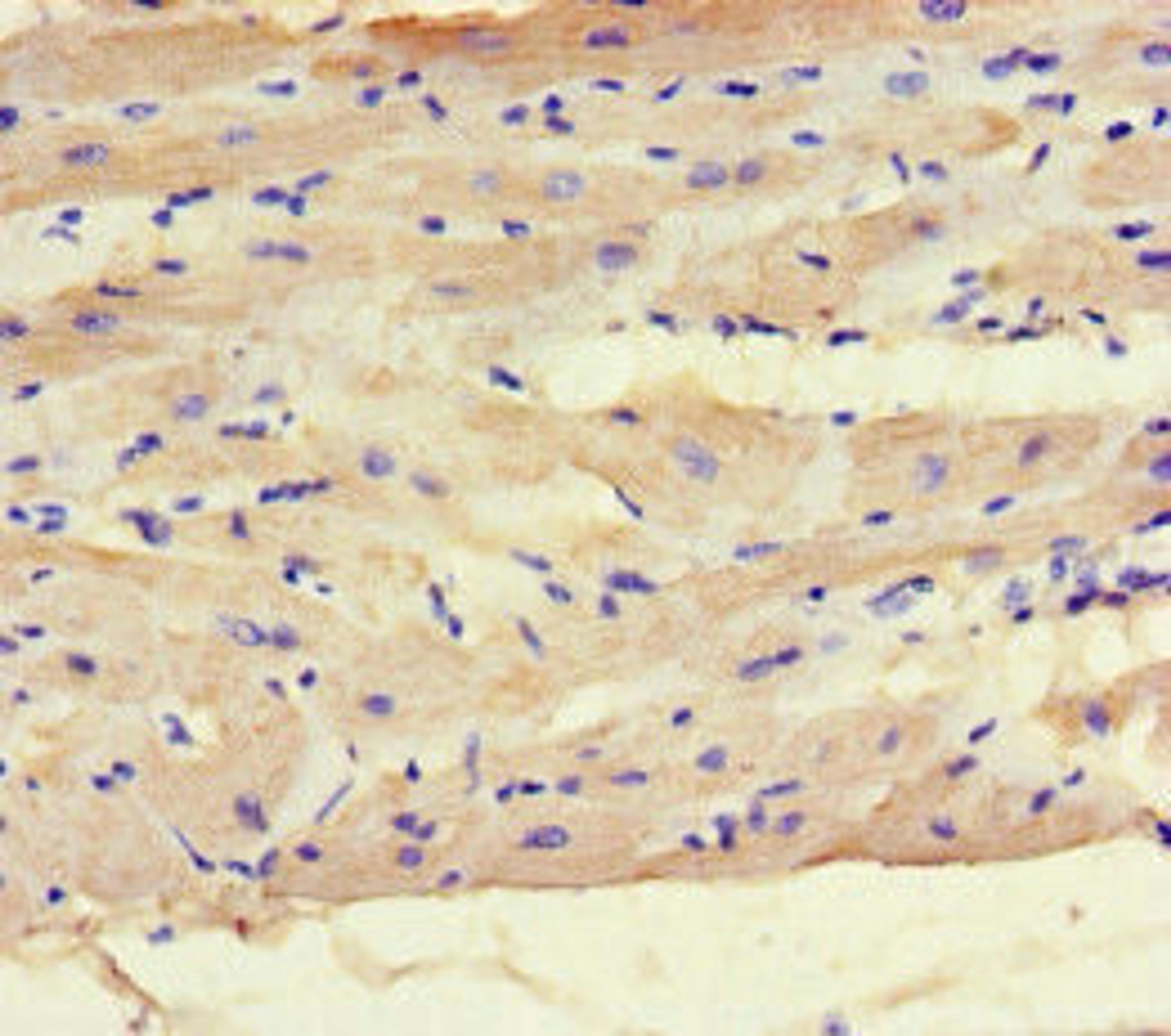 Immunohistochemistry of paraffin-embedded human heart tissue using CSB-PA013527LA01HU at dilution of 1:100