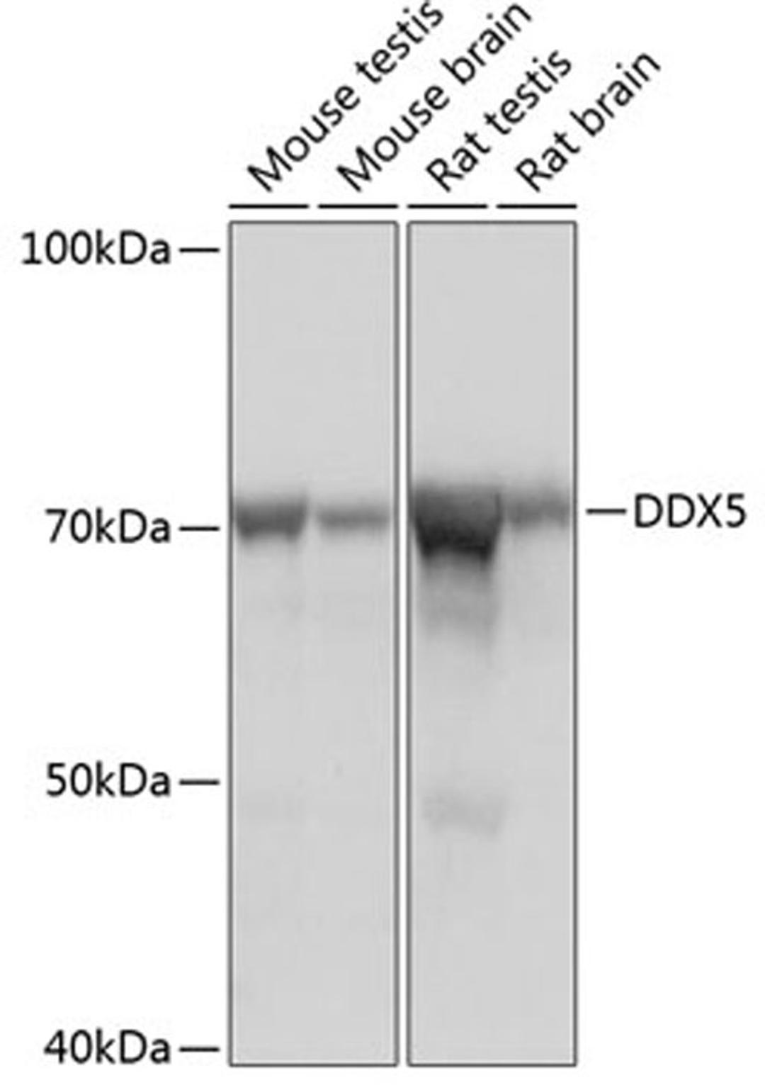 Western blot - DDX5 Rabbit mAb (A11339)