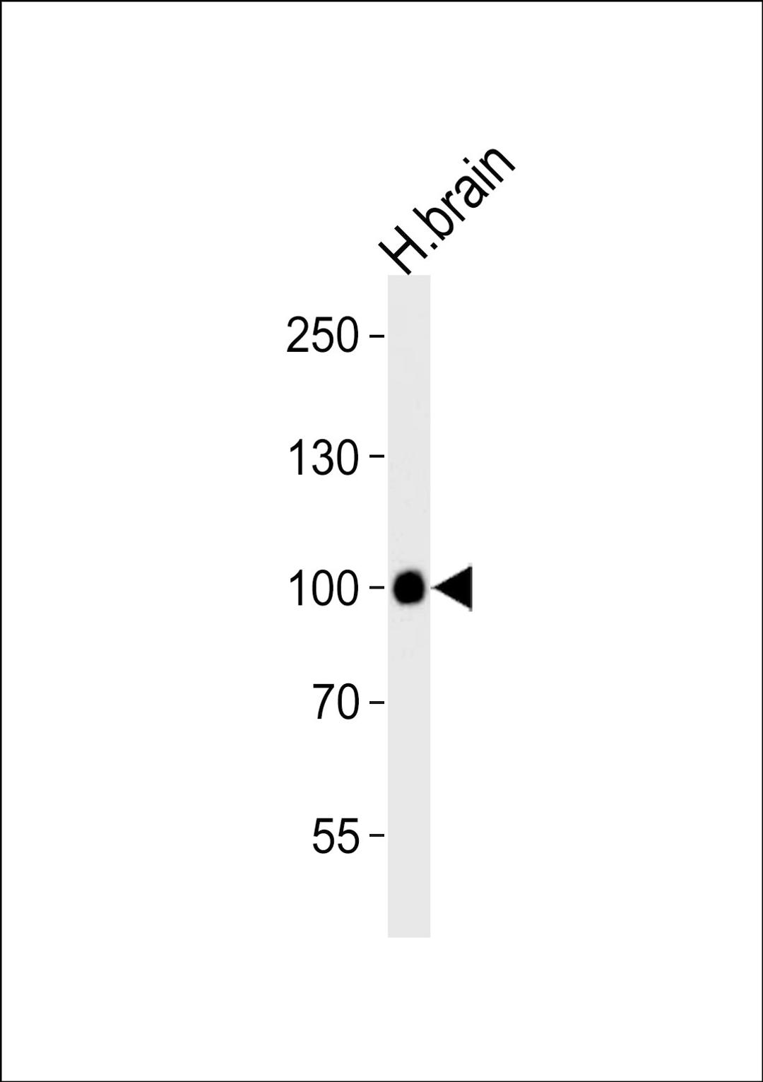 Western blot analysis of lysate from human brain tissue lysate, using CDH13 Antibody at 1:1000 at each lane.