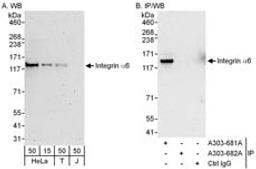 Detection of human Integrin Alpha 6 by western blot and immunoprecipitation.