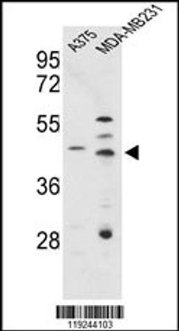 Western blot analysis of CTSD Antibody in A375, MDA-MB231 cell line lysates (35ug/lane)